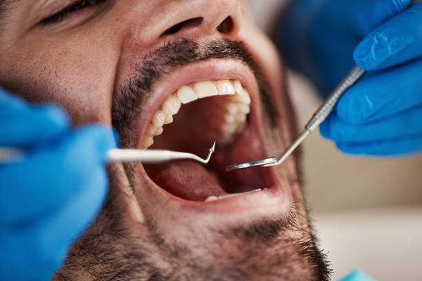 Best Emergency Treatment for Dental Infections or Abscesses in Meyers, CA